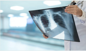 Radiologie en grève : des cabinets fermés pour alerter sur la réforme