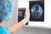 France / Cancer : se faire davantage d&eacute;pister