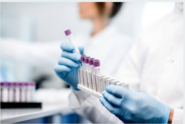 Besan&ccedil;on : les salari&eacute;s des laboratoires d&rsquo;analyses m&eacute;dicales mobilis&eacute;s pour leurs salaires et leurs conditions de travail